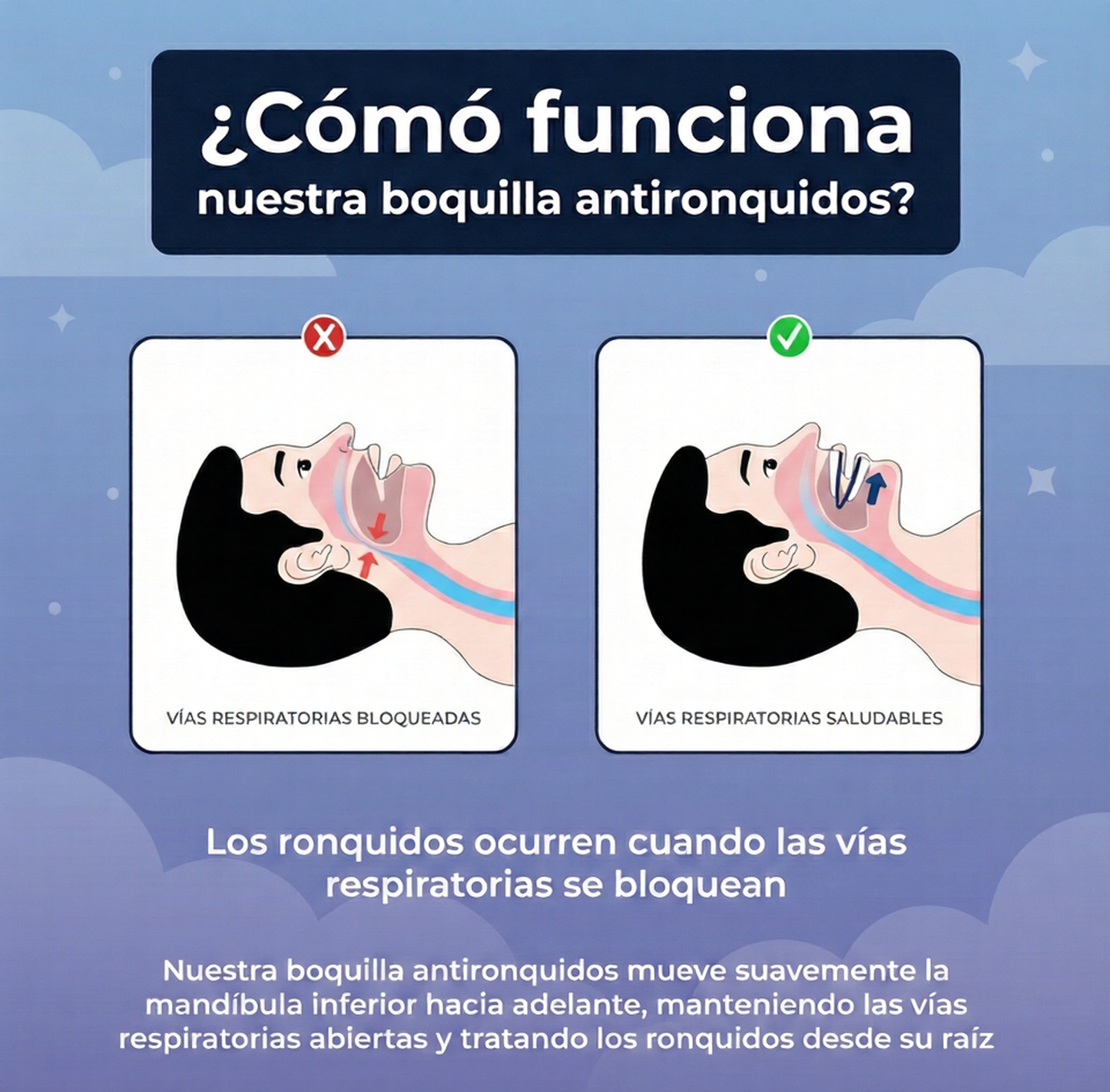 ANTIRONQUIDO NOCTUA