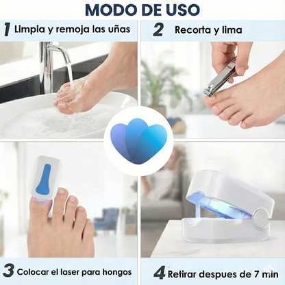 Láser Clean Nail – Tratamiento para hongos en las uñas