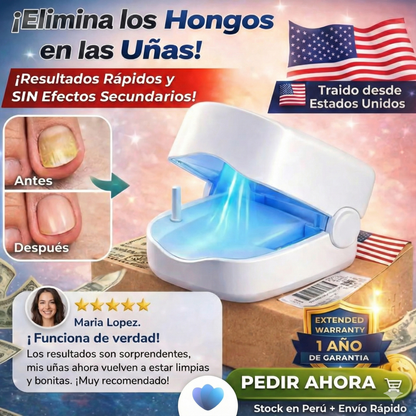 Láser Clean Nail – Tratamiento para hongos en las uñas