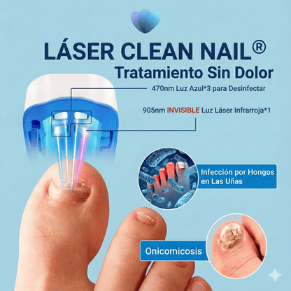 Láser Clean Nail – Tratamiento para hongos en las uñas