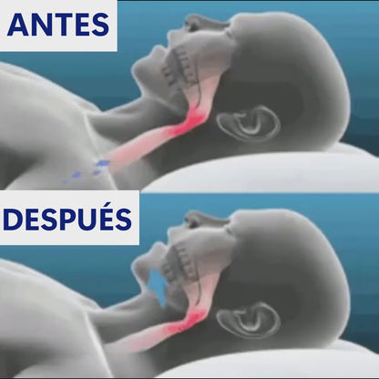 ANTIRONQUIDO NOCTUA